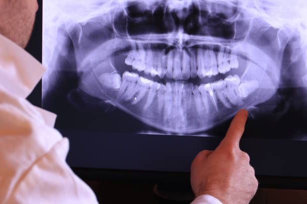 Best Broken or Cracked Tooth Emergency Dentist in Fort Deposit, AL