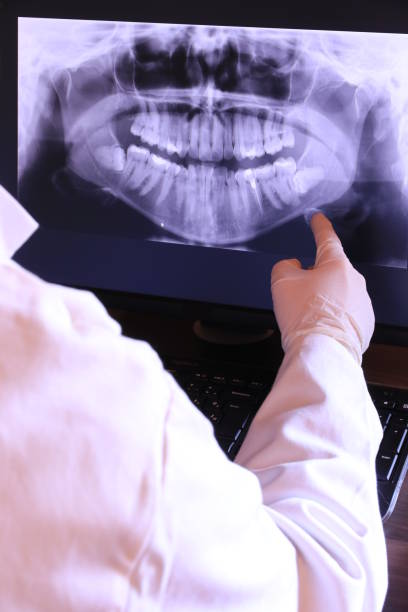 Best Emergency Dental Extractions in Fort Deposit, AL